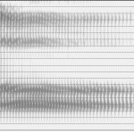 Spectrogramme de la voyelle [ɑ]