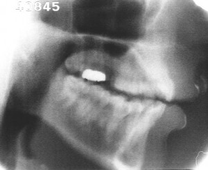 Radiographie de [y]