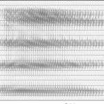 Spectrogramme de la voyelle [ø]