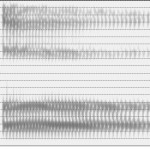 Spectrogramme de la voyelle [ɔ]