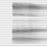 Spectrogramme de la voyelle [œ̃]